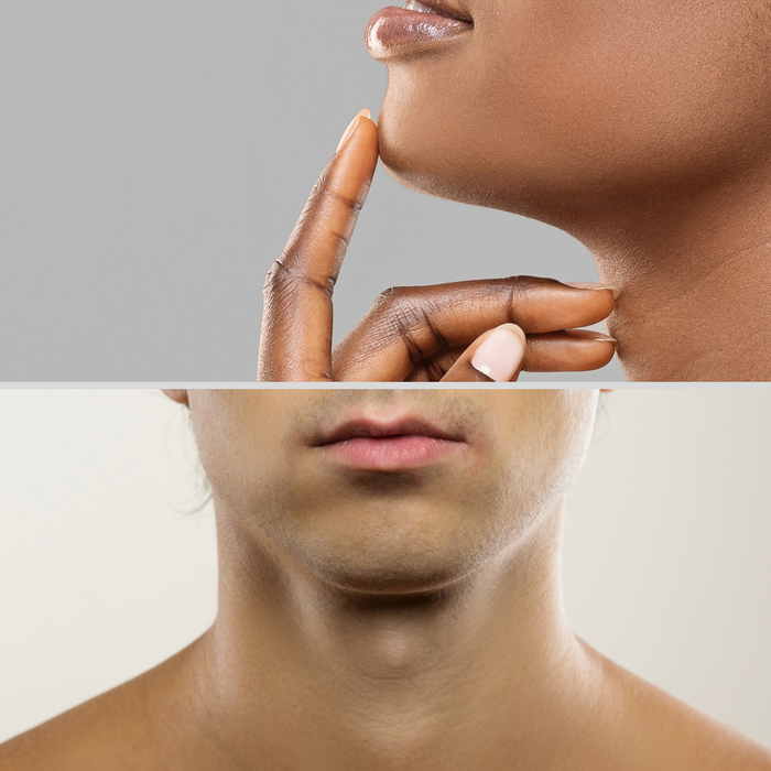 Chin Laser
