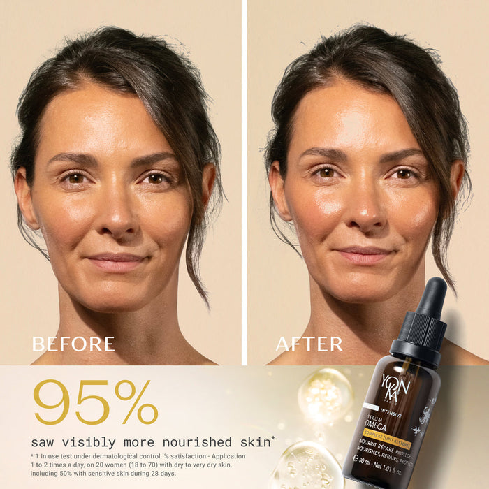 Before and after comparison of a woman’s face showing improved skin hydration and nourishment after using Serum Omega | Yon-Ka Paris skincare product.