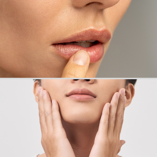 Upper Lip Laser